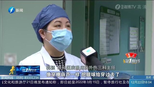 心疼!枪钉已没过3岁男童眼球 医生手术取出3厘米长钉子