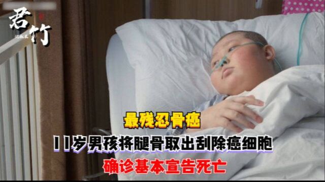 最残忍骨癌:11岁男孩将腿骨取出刮除癌细胞,确诊基本宣告死亡