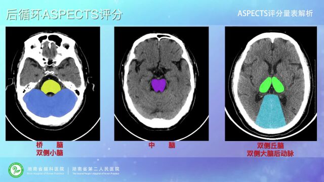 脑卒中临床评估9大量表,教学视频全在这里了,赶快收藏!