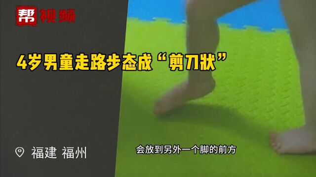 男童因脑瘫导致“剪刀腿” 手术使用“电生理监测”乃我省首例