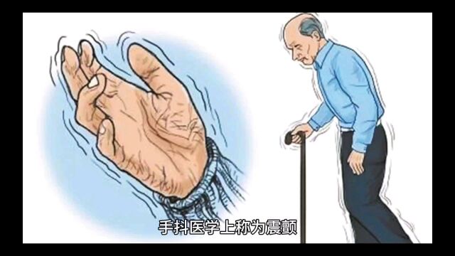 手抖医学上称为震颤