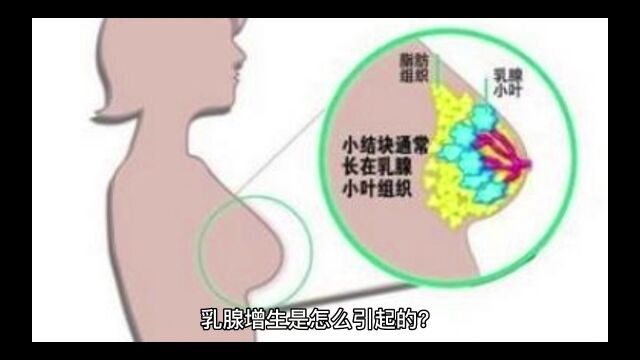 80%患病率的乳腺增生真的不用治疗吗?做好这几点预防癌变!