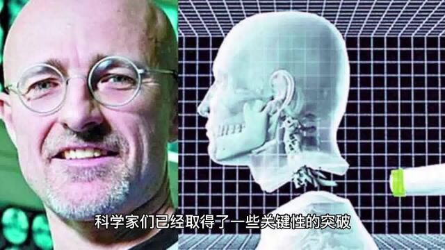 人脑移植:探讨科学界最新突破,人脑移植技术是否真的有可能成为现实.