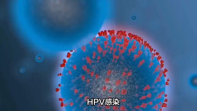 HPV感染如何治疗南京家和医院