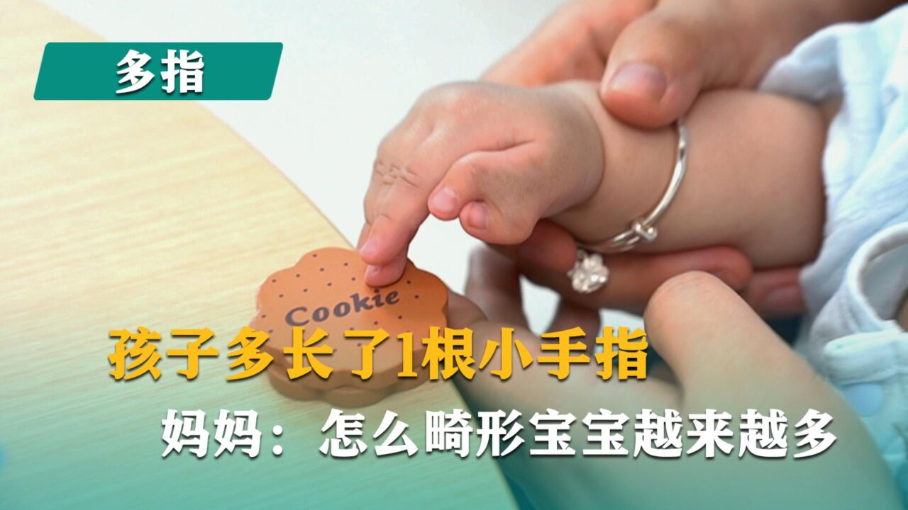 孩子多长了1根小手指,妈妈:怎么畸形宝宝越来越多