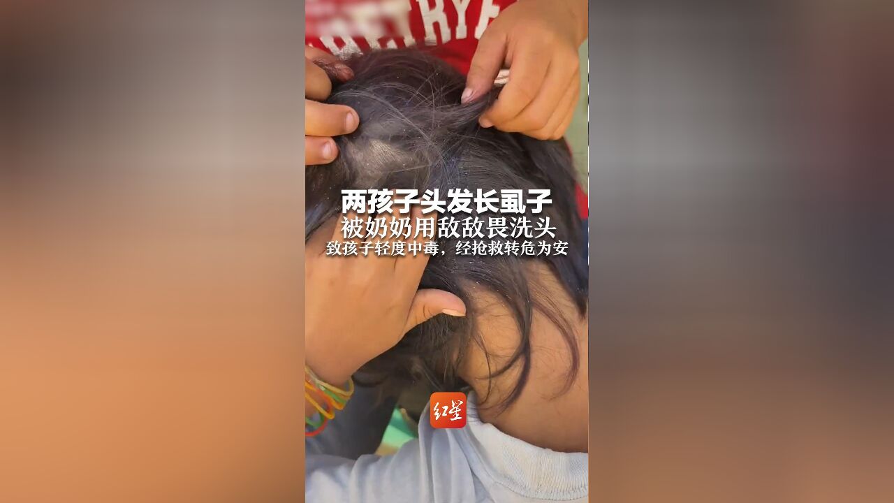 两孩子头发长虱子 被奶奶用敌敌畏洗头 致孩子轻度中毒,经抢救转危为安