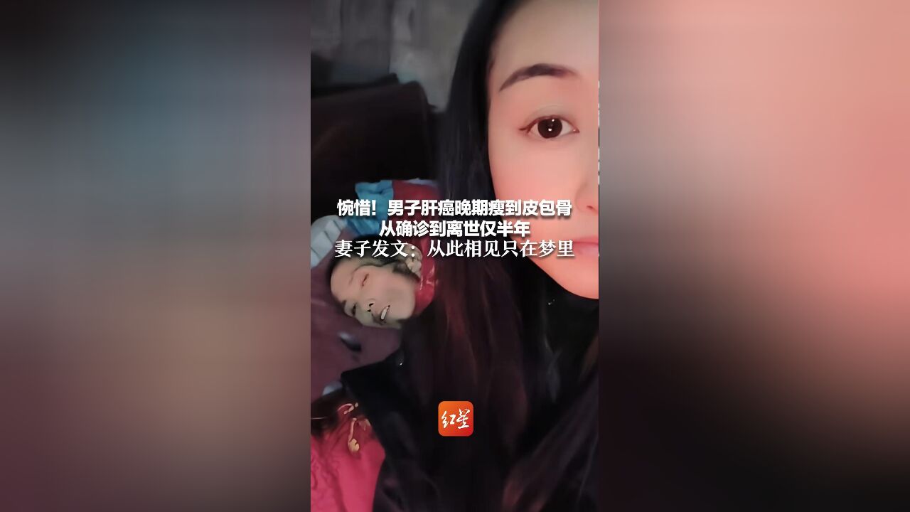 惋惜!男子肝癌晚期瘦到皮包骨 从确诊到离世仅半年 妻子发文:从此相见只在梦里