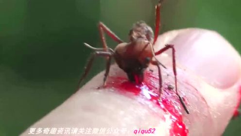 号称最强悍蚂蚁！ 男子被咬60秒后直击惊人结果