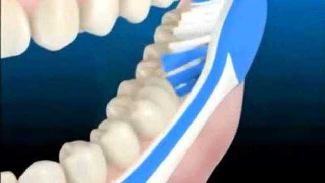 口腔科普:视频演示正确刷牙方式,巴士刷牙法!