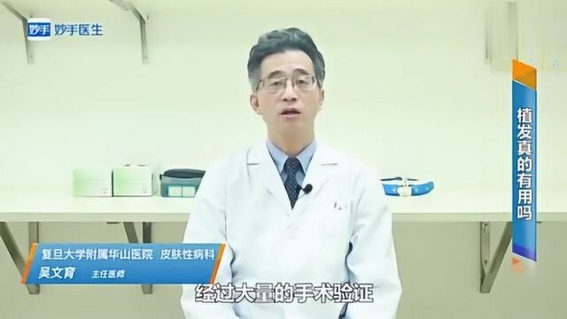 植发真的有用吗?医生告诉你实情!