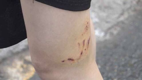 梦魇交织，狗与猫的追逐——解析未出血的咬痕背后深层含义