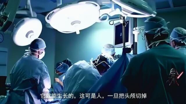 换头手术真的成功了!我国科学家参与手术,仅18小时就完成