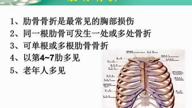 肋骨骨折的治疗