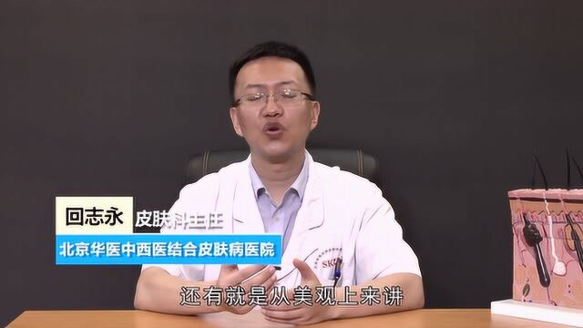 激素依赖性皮炎的危害有哪些?皮肤科主任回志永