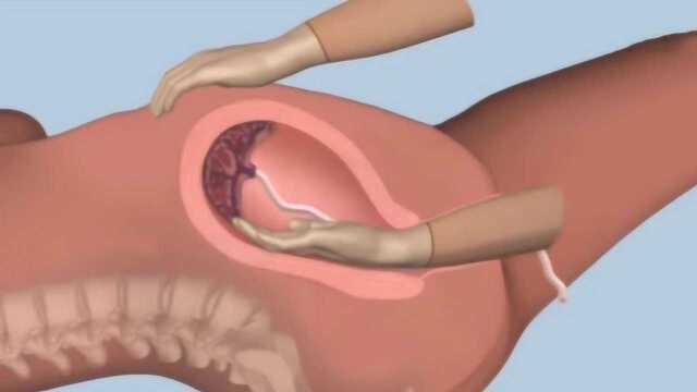 产妇手剥胎盘有多疼?3D动画演示全过程,看完心疼妈妈