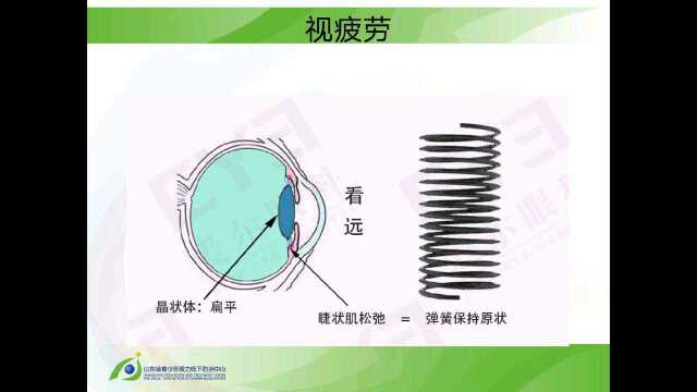 如何缓解视疲劳