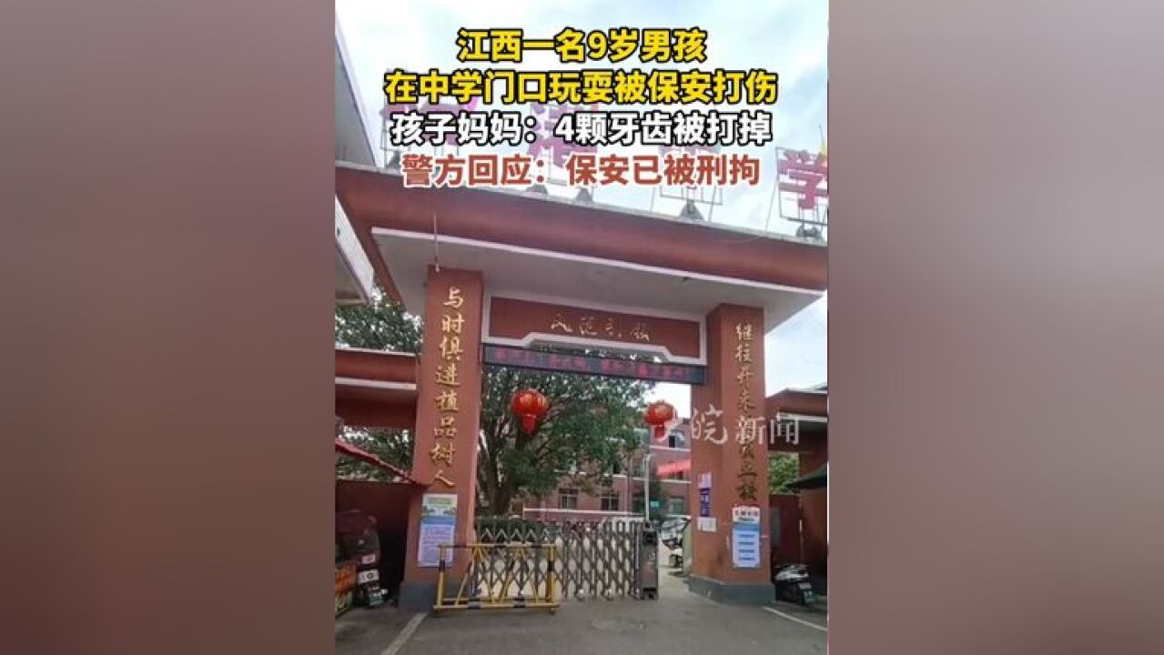 江西一名9岁男孩 在中学门口玩耍被保安打伤 孩子妈妈:4颗牙