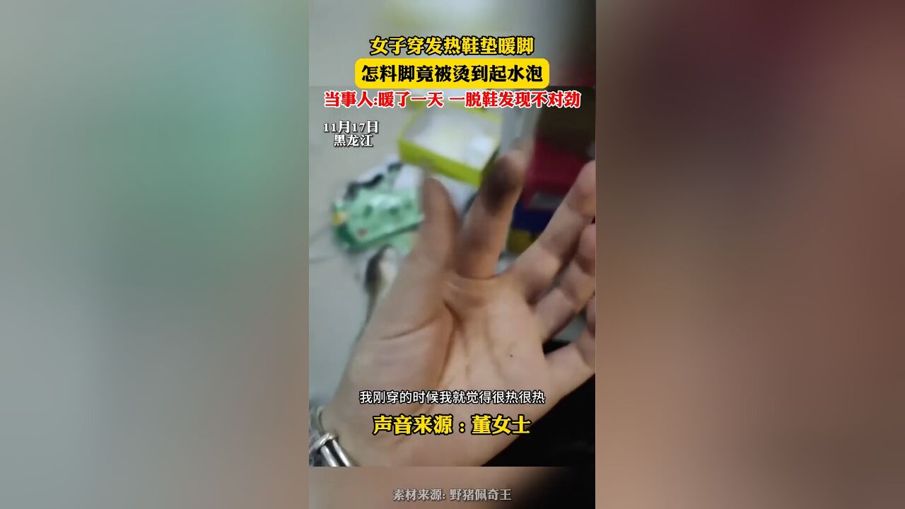 女乎穿发热鞋垫暖脚,怎料脚竞被烫到起水泡