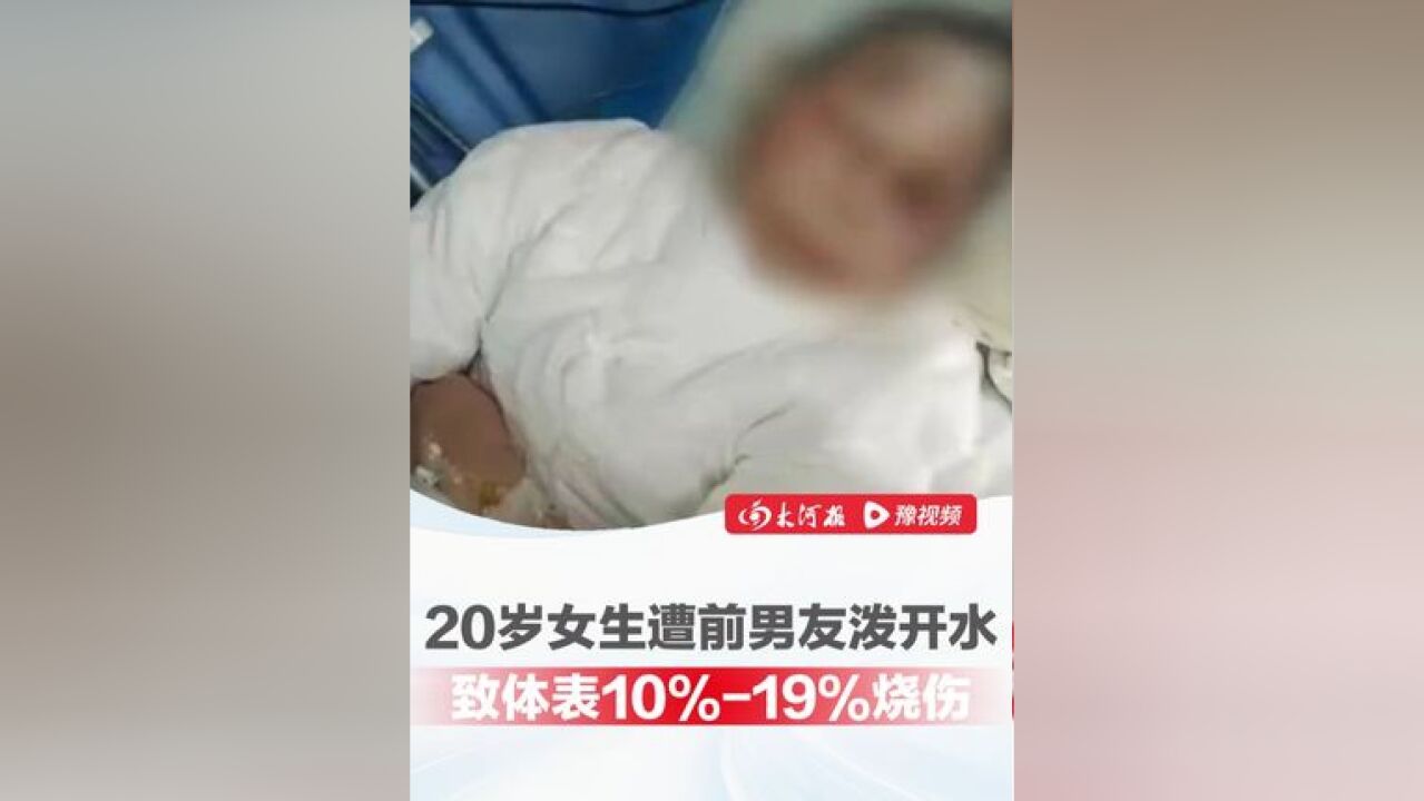 20岁女生遭前男友泼开水,致其体表10%19%烧伤,家属:保命的话第一笔要花20万元