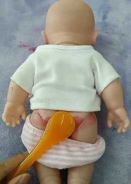 家长们千万不要再打宝宝的屁股了，否则后果很严重