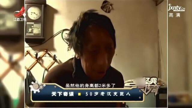 5旬老汉身高突然疯长30厘米,长成两米多巨人,头部长成卡通人物