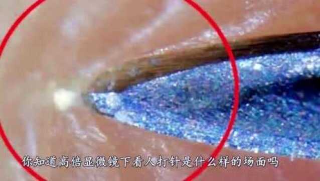 高倍显微镜下看人打针,针管不规则,一层层扎进去真疼!