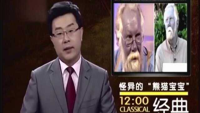 看世界:40岁大叔竟变成真人版“阿凡达”,周身皮肤变成蓝色令人脊背发凉