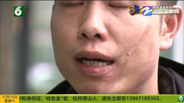 杭州众乐足道拔火罐突发意外,宁先生脸部手臂都烧伤,再也乐不出来!