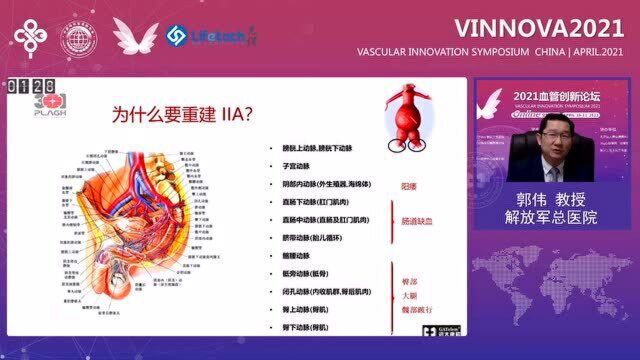 郭伟教授《腔内重建髂内动脉:我们的执着追求》@血管资讯