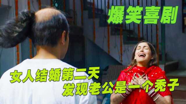 爆笑喜剧《巴拉》小伙年仅25秃顶,为治秃顶用了210种方法