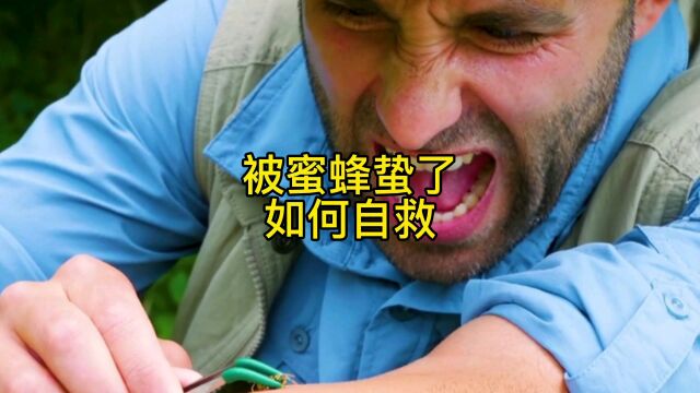 被蜜蜂蛰了如何自救