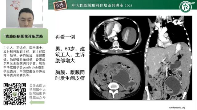 腹膜病变的影像分析思路中大王远成