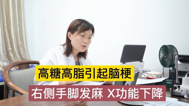 57岁糖友高糖高脂引起脑梗,劝诫糖友要积极配合医生控制好血糖