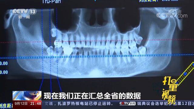 种植牙医疗服务4500元指导价公布,种植体耗材怎么降?