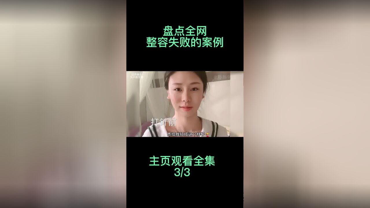 盘点全网整容失败的案例,整得连亲妈都不认识,何必糟蹋自己呢?