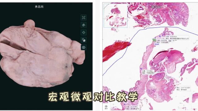 人体医学形态学教学系统,洪宇医教形态学软件展示