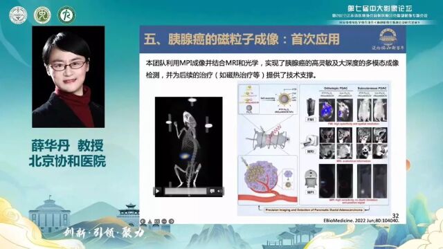 胰腺癌分子影像研究进展北京协和医院薛华丹