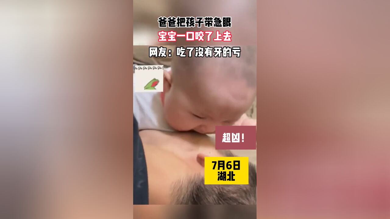 爸爸把孩子带急眼,宝宝一口咬了上去……