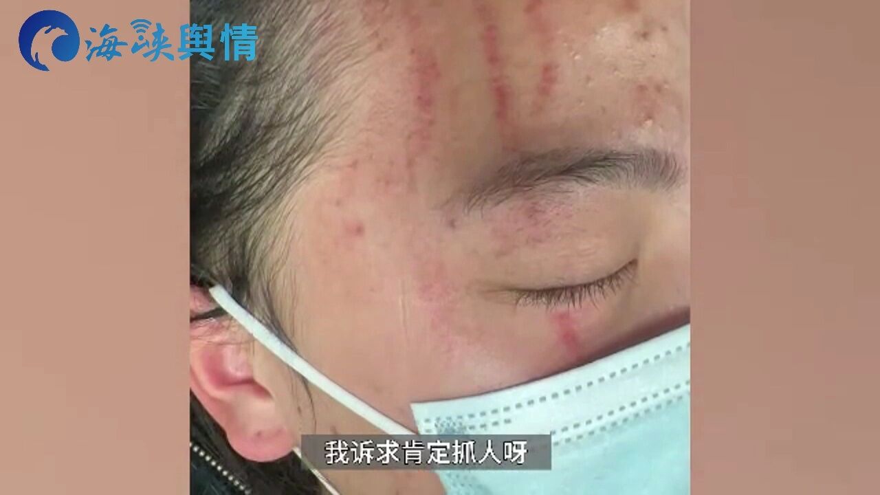 男子称4人半夜醉酒上门收物业费,起争执后打断孩子2根手筋,物业回应