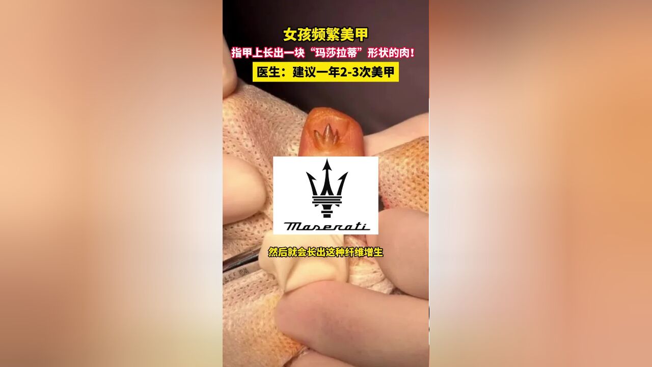 女孩频繁美甲,指甲上长出一块“玛莎拉蒂”形状的肉!医生:建议一年23次美甲