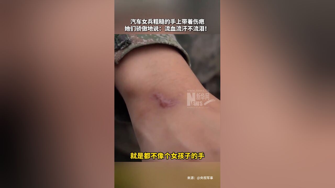 汽车女兵粗糙的手上带着伤疤,但她们骄傲地说:流血流汗不流泪!