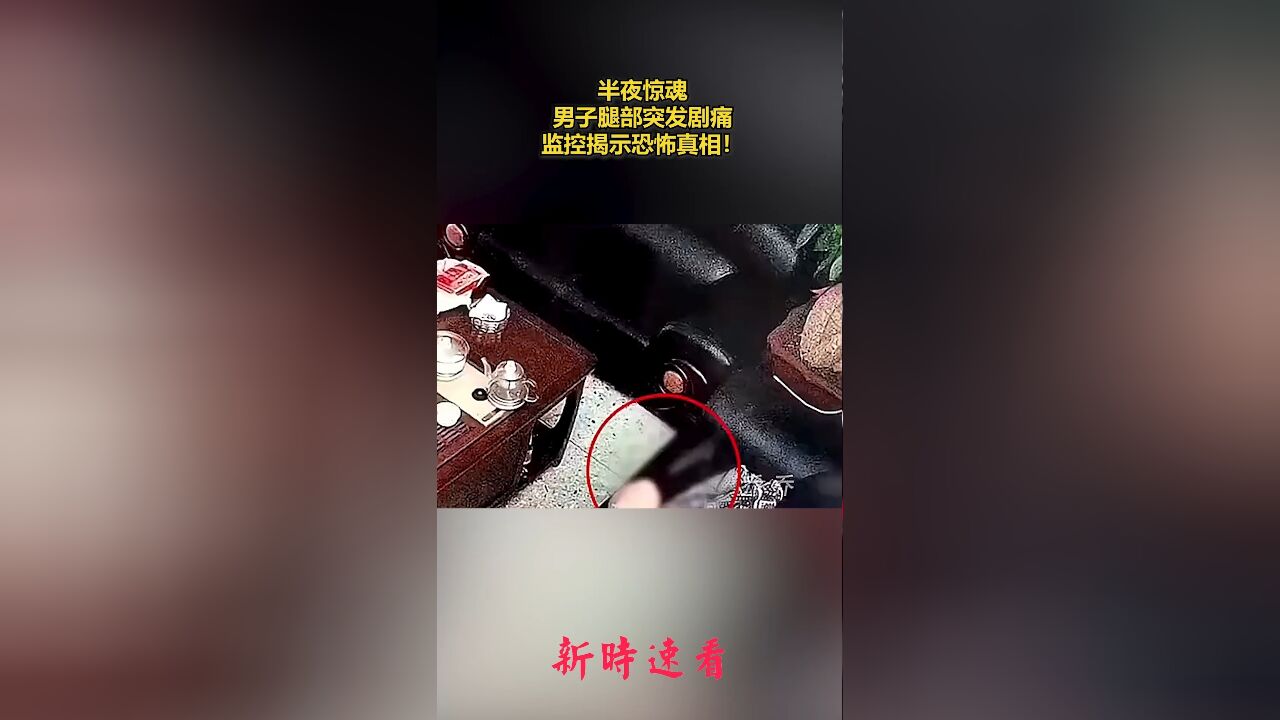 半夜惊魂,男子腿部突发剧痛,监控揭示恐怖真相.