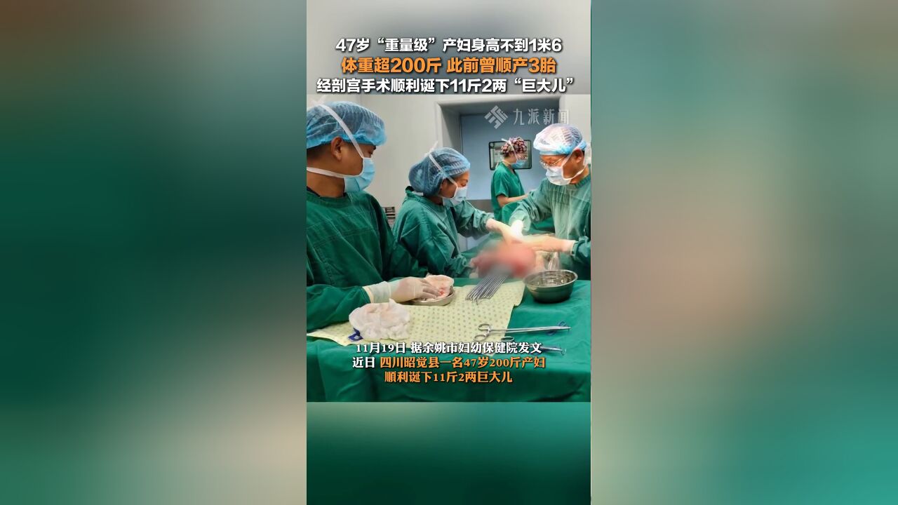 47岁200斤产妇诞下11斤2两男婴,此前曾顺产3胎