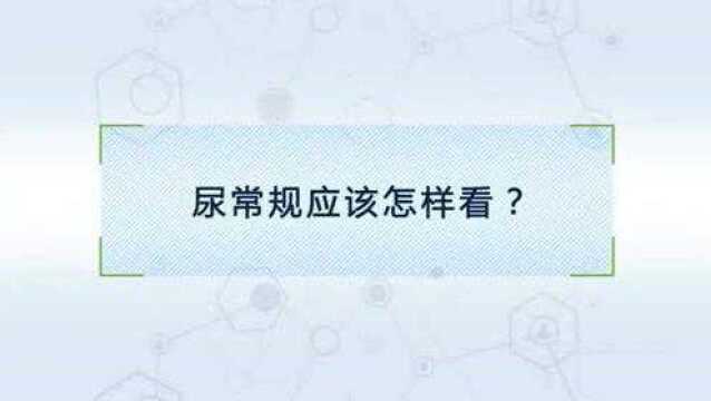 尿常规应该怎么检查