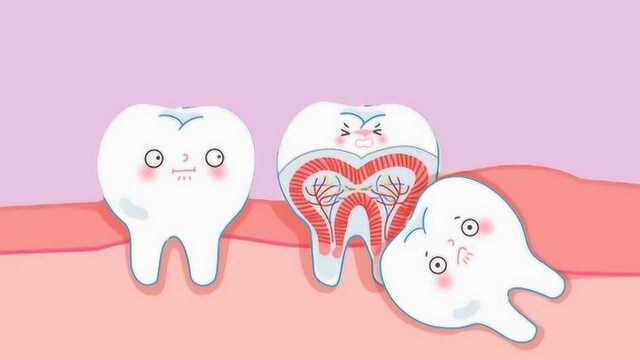 关于智齿必须知道的事,口腔专家告诉你