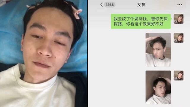 95后秃发小伙为爱纹发际线,女神一句话吐槽亮了:应该去植发