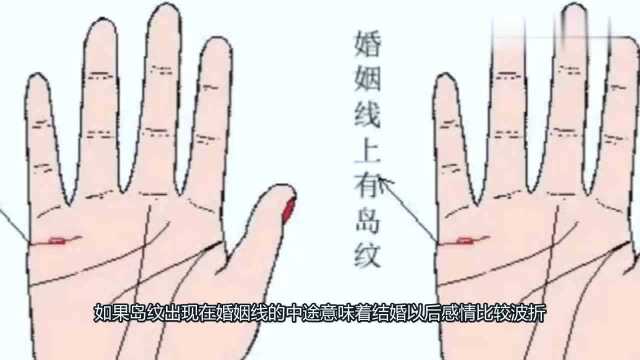 “岛纹”究竟代表什么?手上这些地方有岛纹要留意!