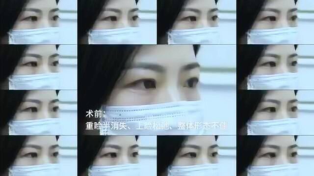 “超自然”的美眼修复效果