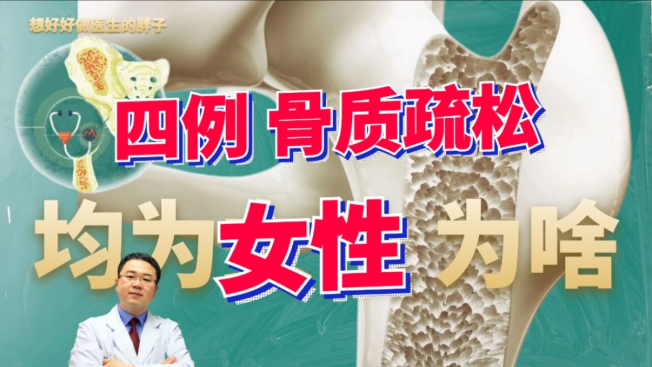 1天门诊,确诊4例骨质疏松症,皆为50多岁女性,为啥?