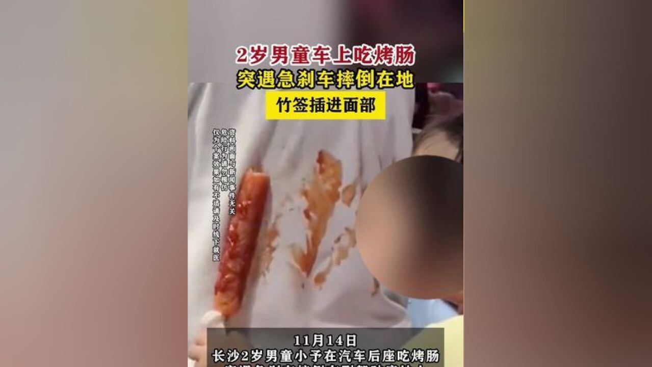 2岁男童车上吃烤肠遇急刹竹签插进面部